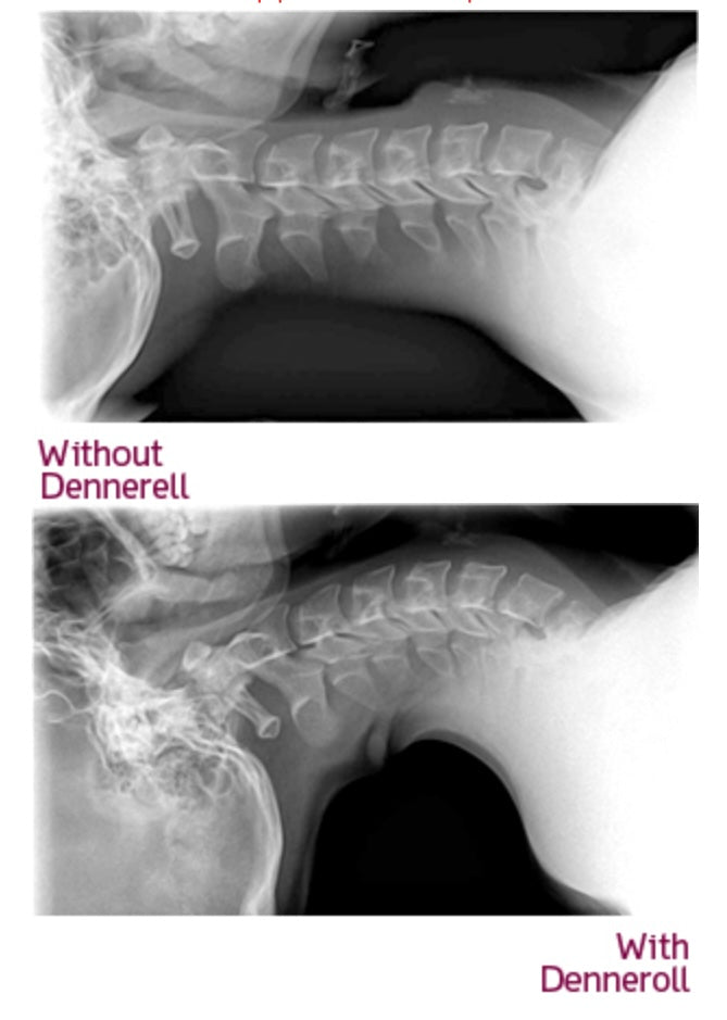 Denneroll Orthotic Pillow | Cervical Spine Support